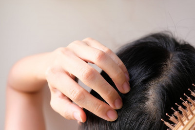 4 Hal yang Bisa Sebabkan Rambut Rontok dan Menipis